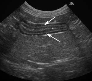 ultrasonographic study of cat jejunum with IBD or small-cell lymphoma