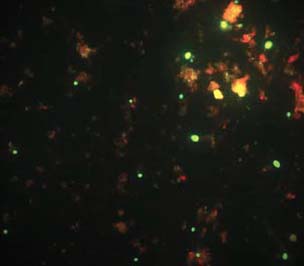 direct immunoflourescence assay of kitten diarrhea causing giardia in feces